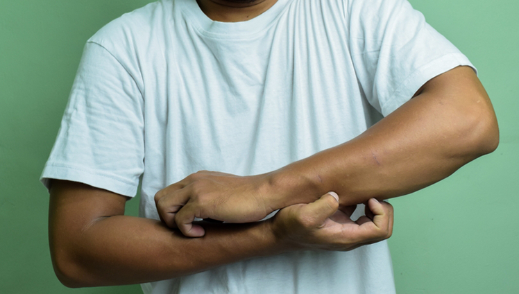 A closeup of a person itching their arms.